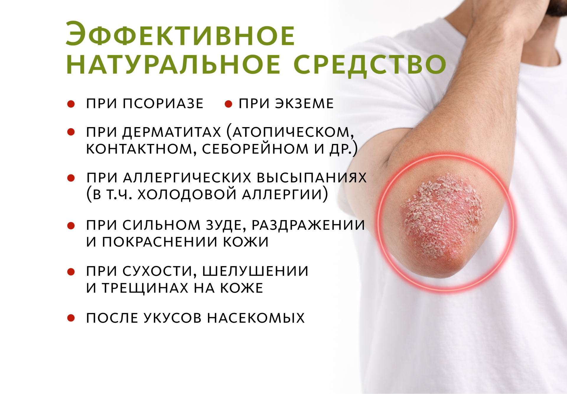 «Шици»  крем от псориаза и экземы традиционный китайский