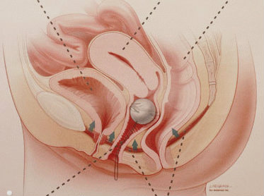 Katta kokrakli etuk ayollarning retro pornosi Endi semiz keksa ayollar ishtirokidagi porno video